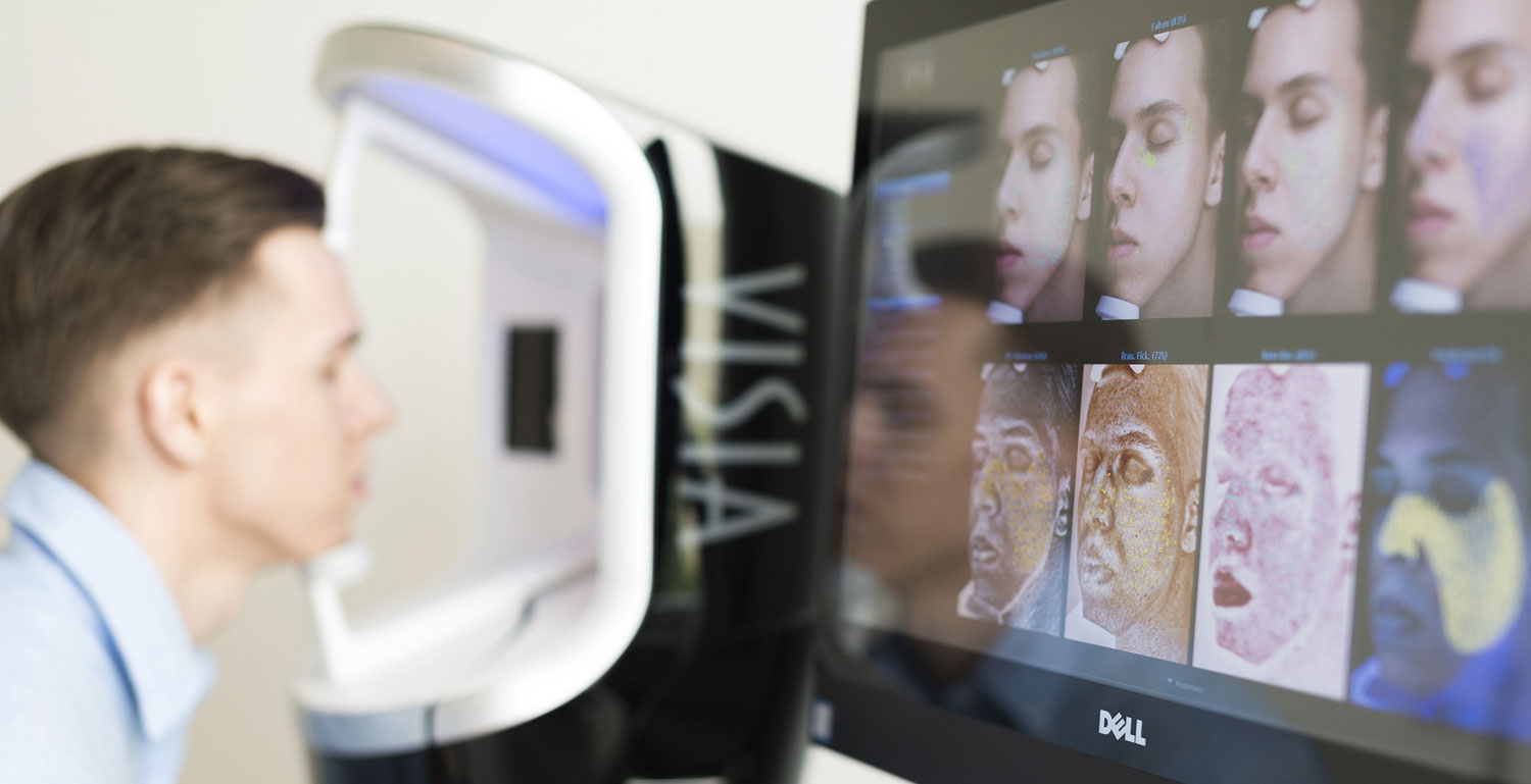 Wir arbeiten mit dem fortschrittlichsten Hautanalyse-System VISIA